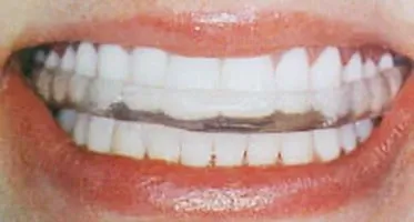 Gnatologia (disfunzioni mandibolari)